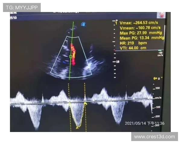 凯发血流成河：提升团队协作能力的实用技巧与战术建议